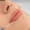 A close-up of a woman's lips receiving a lip filler injection, highlighting the procedure for enhancing lip volume.