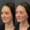 Before and after photo of a patient who received cheek filler treatment at Austin Aesthetic Atelier, highlighting enhanced cheek volume and contour.