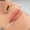 A close-up of a woman's lips receiving a lip filler injection, highlighting the procedure for enhancing lip volume.