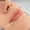 A close-up of a woman's lips receiving a lip filler injection, highlighting the procedure for enhancing lip volume.